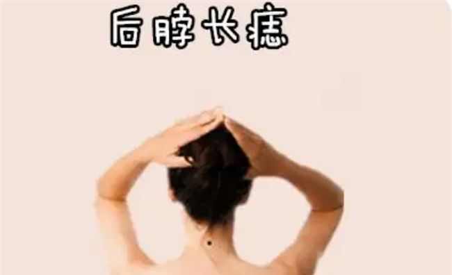 脖子两边都有痣代表什么图3