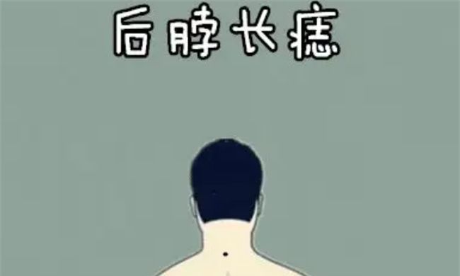 男人哪里长痣有福气图2